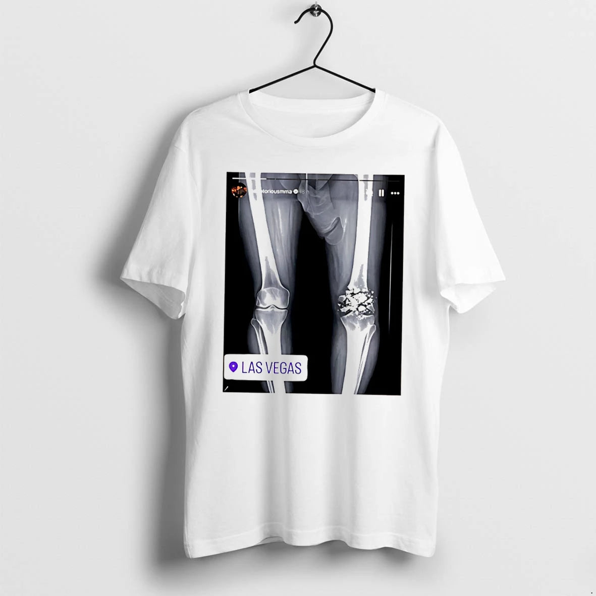 Officials Conor X Ray Broken Knee Knee Funny Tee Premium T Shirt