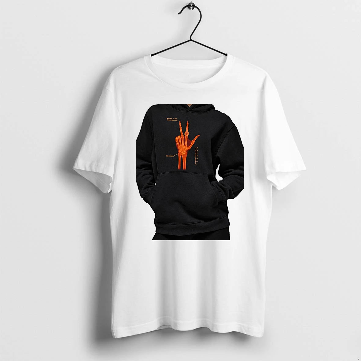 Officials Jalen Brunson Wears Requires Surgery X Ray Premium T Shirt